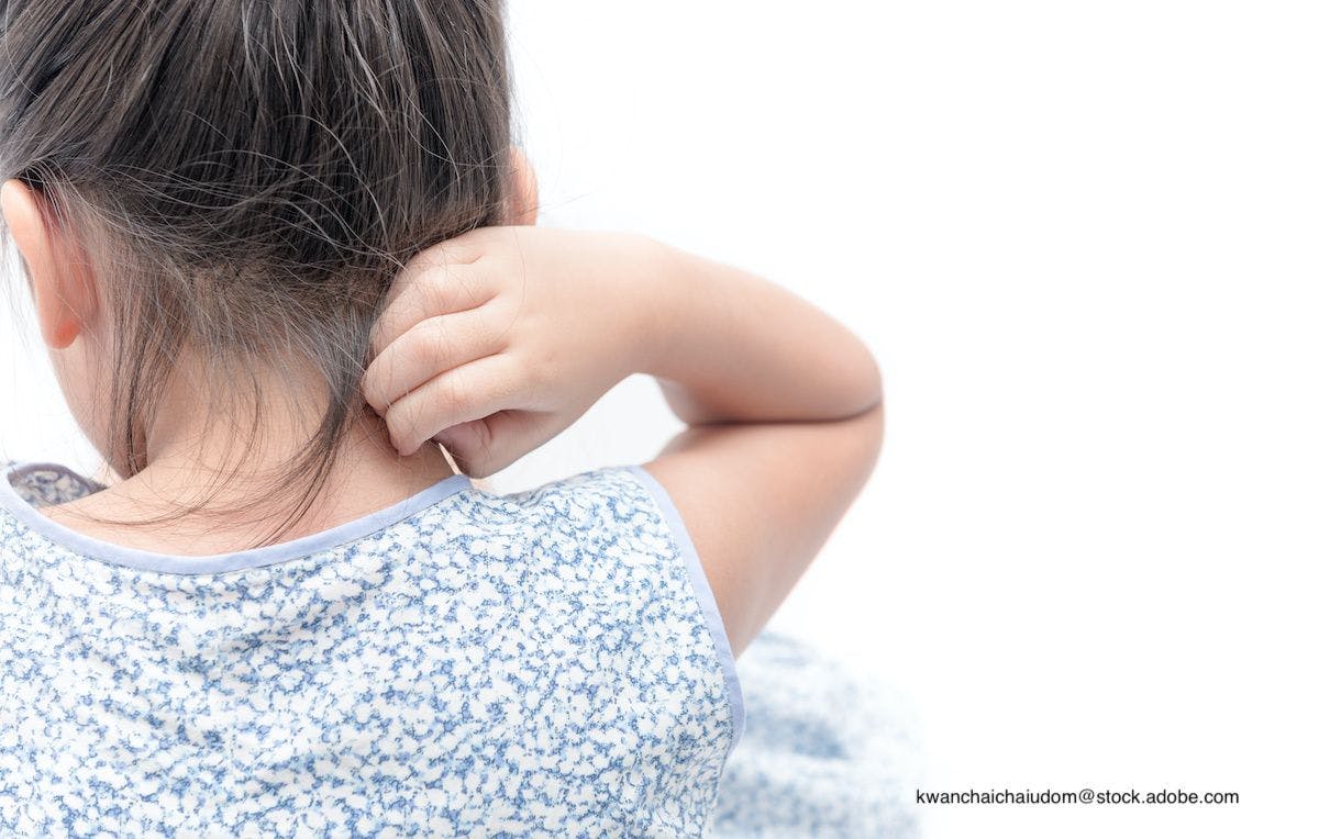 What's out there for assessing itch in kids