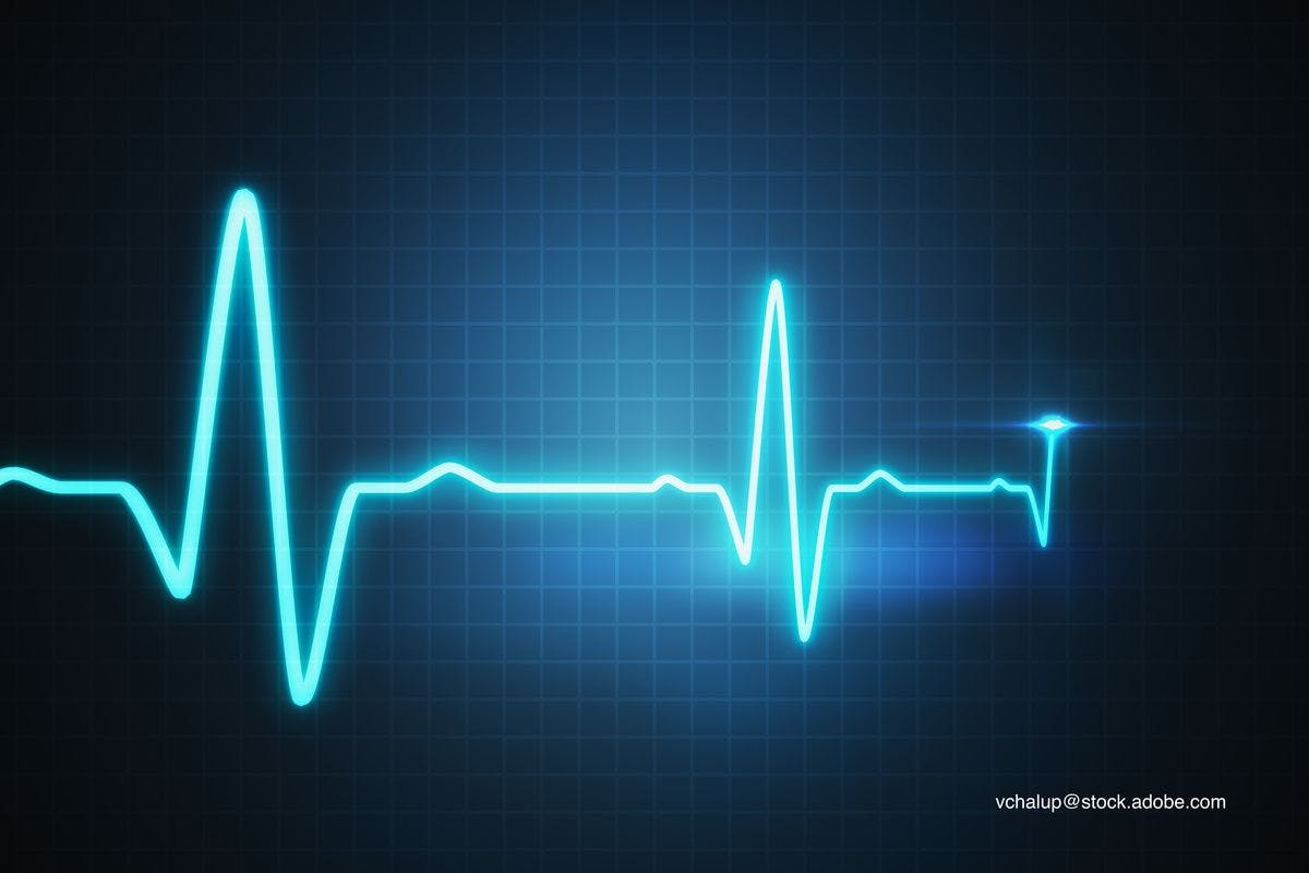 heart monitoring