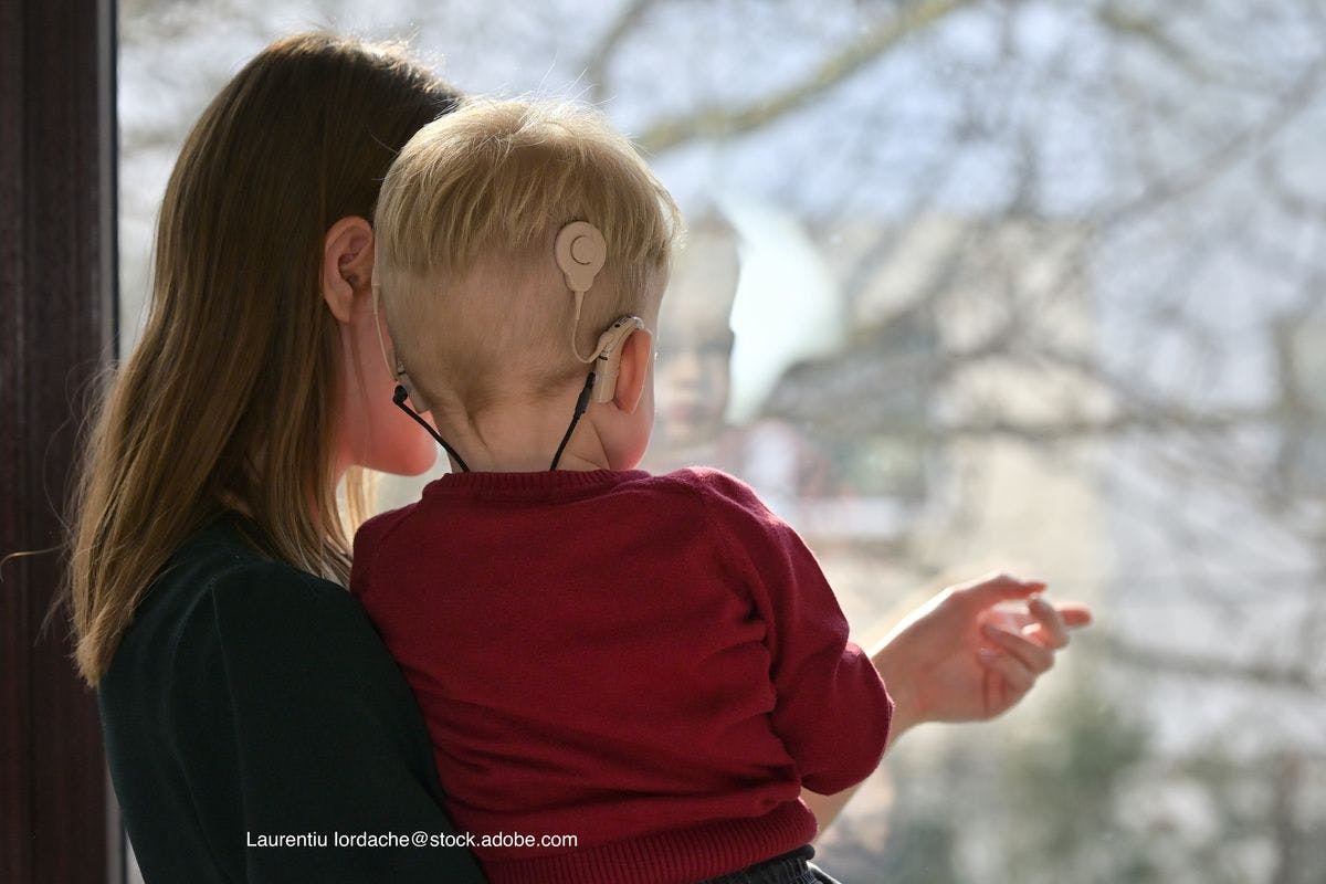 Impact of lockdowns on language exposure for kids with cochlear implants