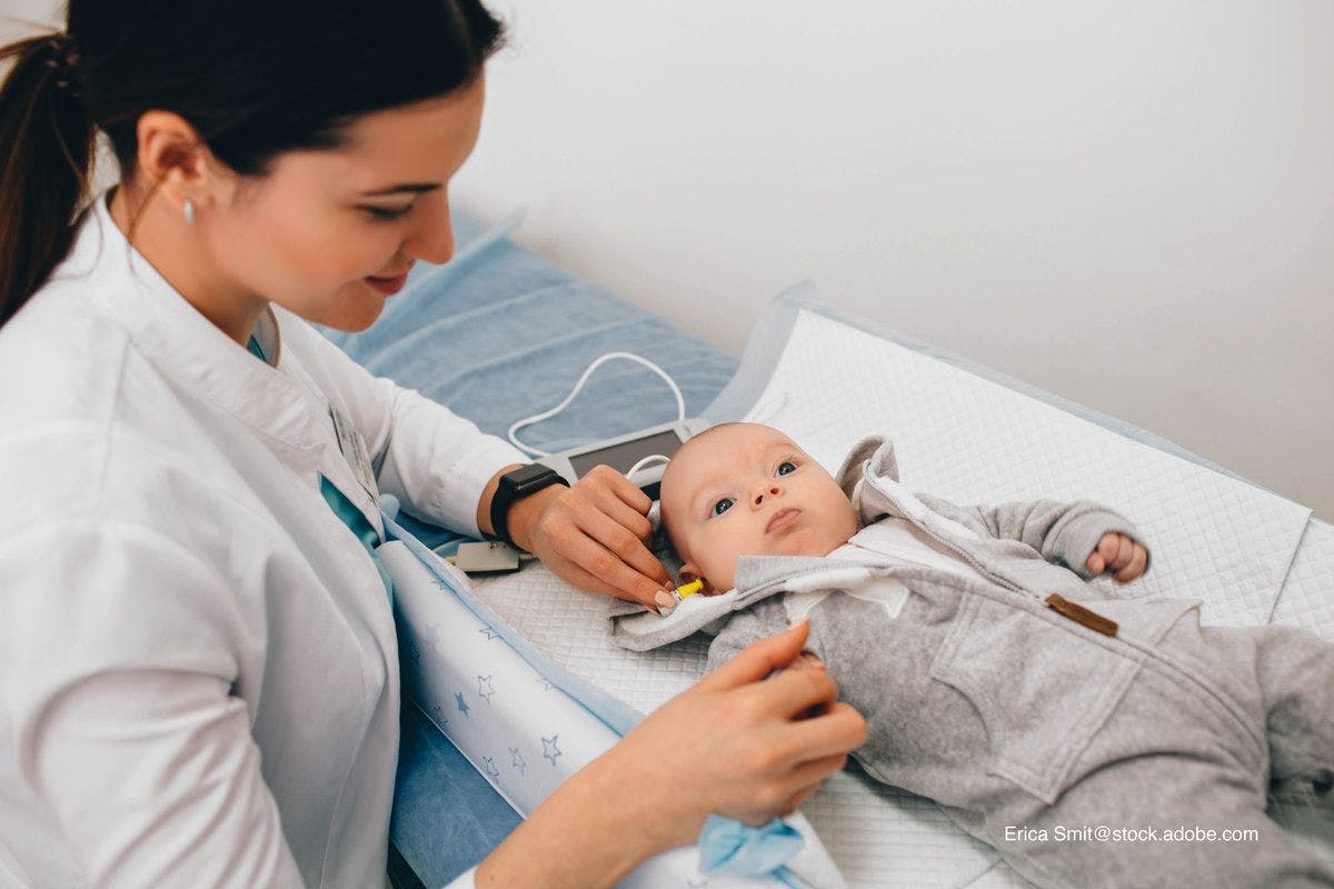 infant getting otoacoustic emissions screening