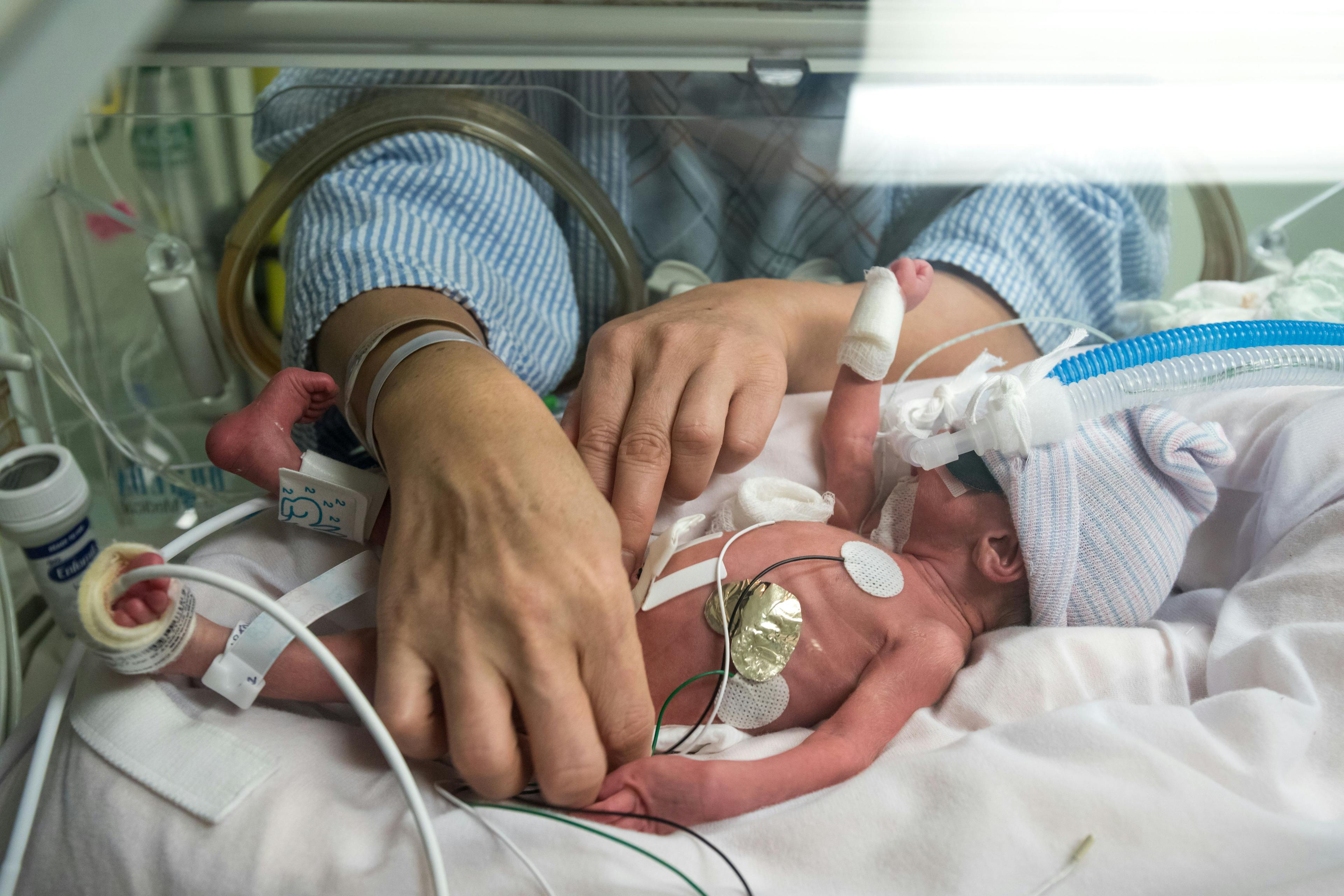 March of Dimes launches new preterm birth research center at UCSF