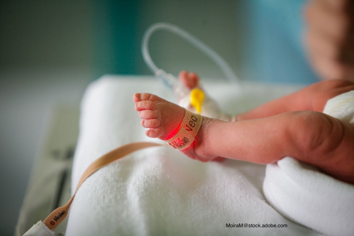   Have neurodevelopmental outcomes improved in extremely preterm children?
