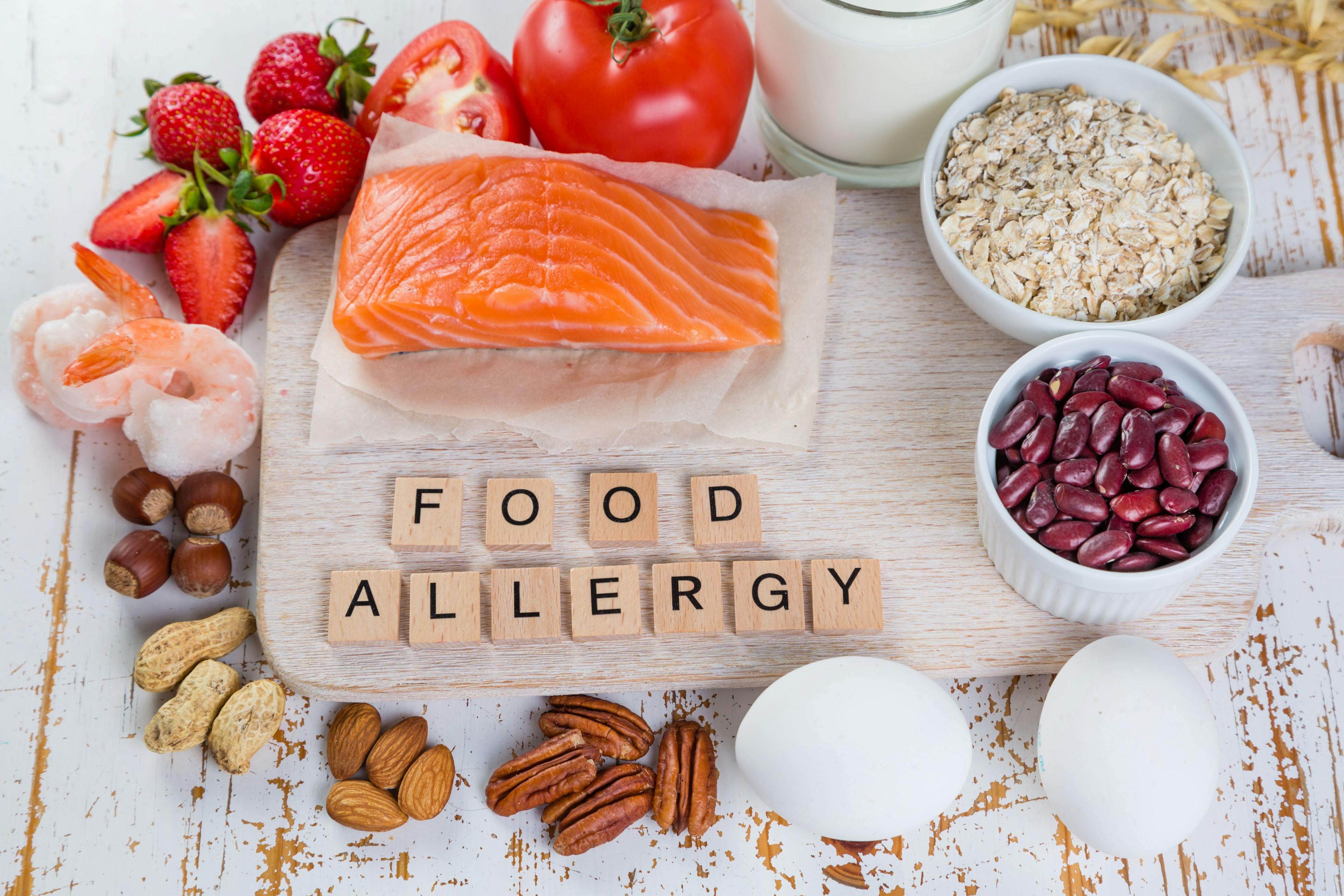 The latest news on food allergies in children
