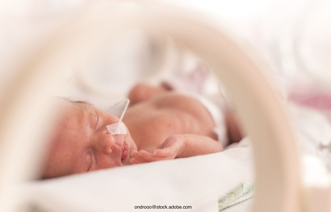Comparing delivery room respiratory support for extremely preterm infants
