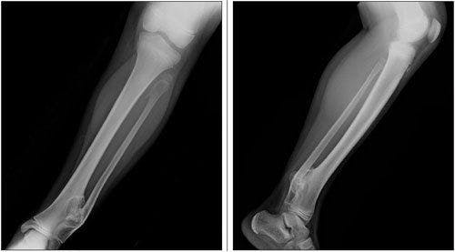 Persistent Ankle Mass in an Otherwise Healthy 9-Year-Old Girl