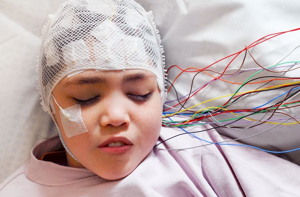 stock image of child receiving an EEG