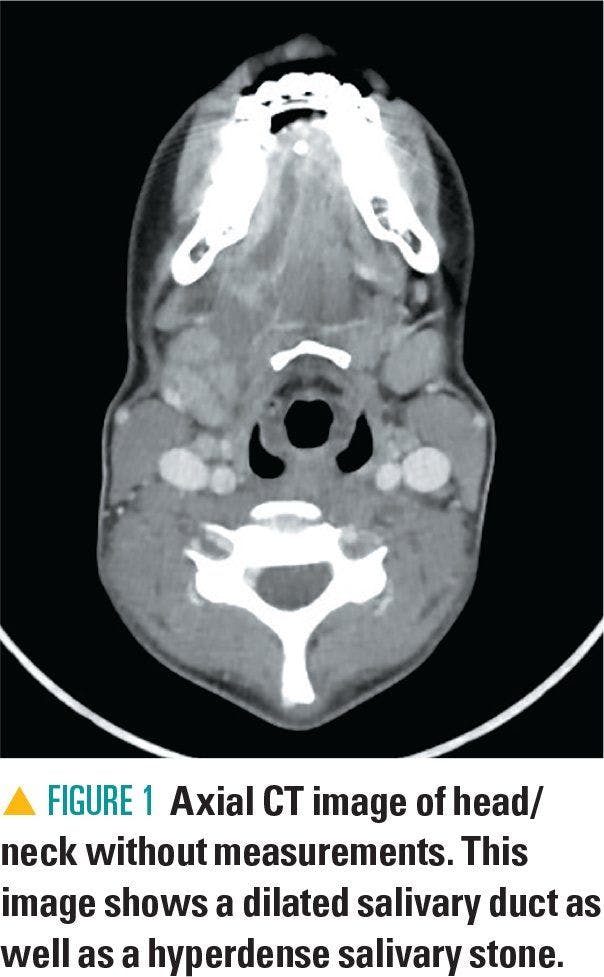Axial CT image of head/neck without measurements