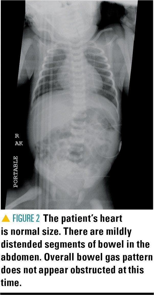 image showing patient's chest and abdomen