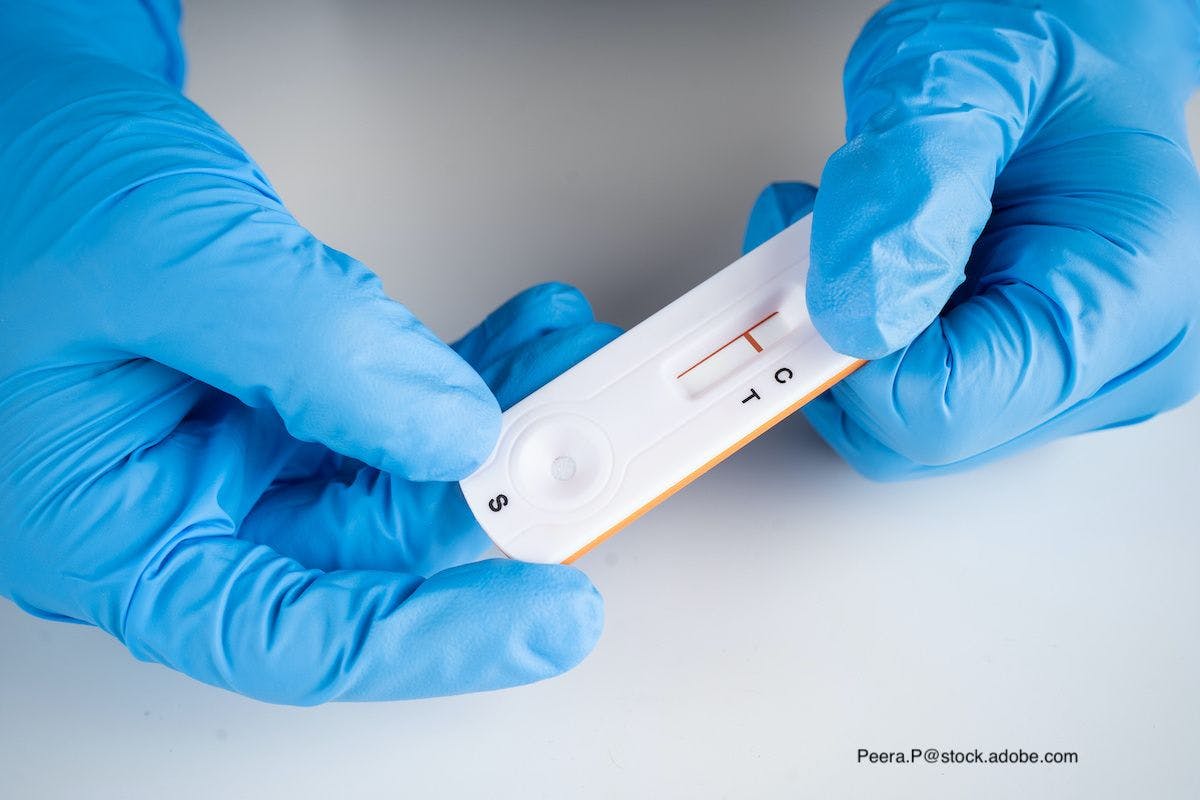 Point-of-care COVID-19 antigen and nucleic acid amplification tests