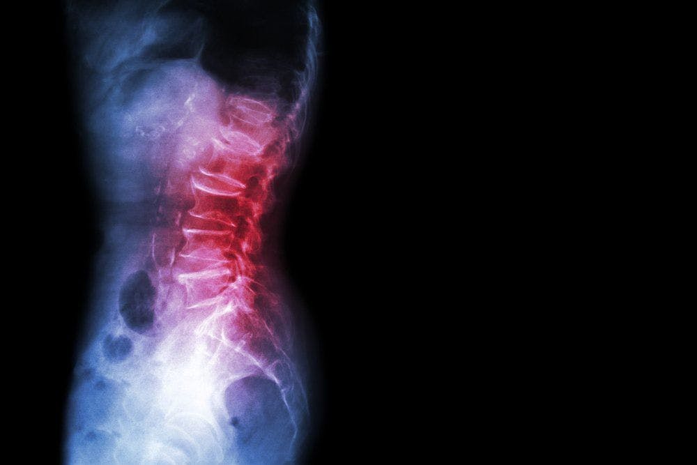 stock image of lower back x-ray