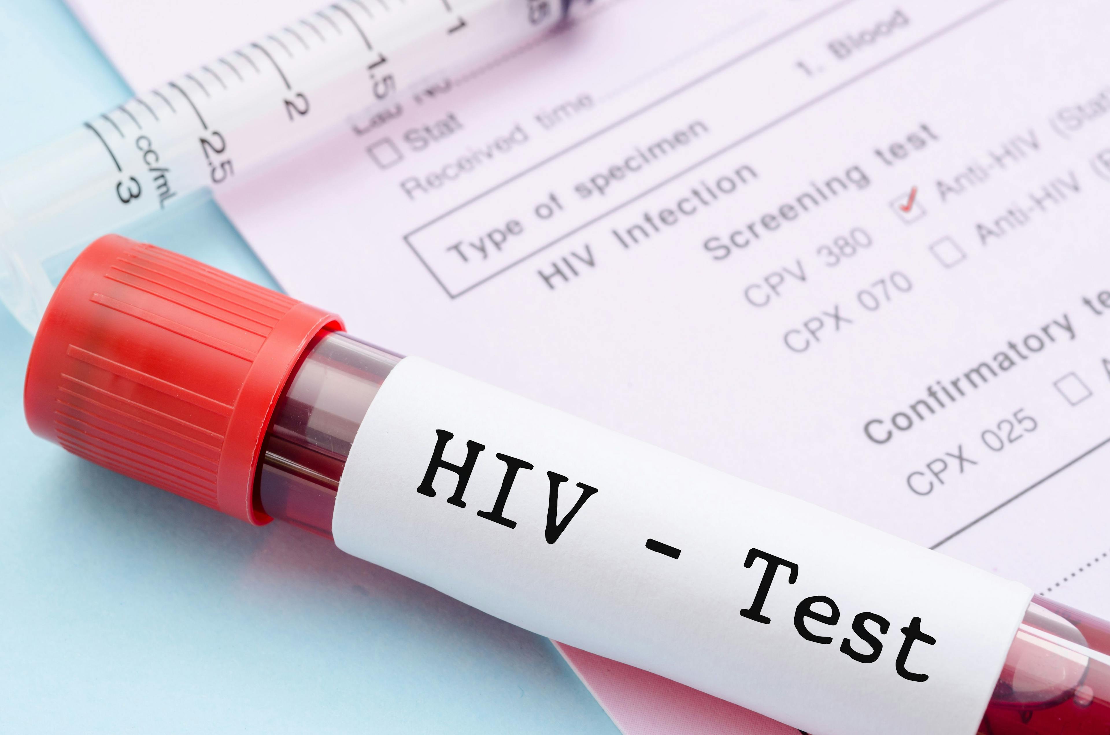 CDC: Decline in youth HIV infections drove overall decline in 2021 | Image Credit: © gamjai - Image Credit: © gamjai - stock.adobe.com.