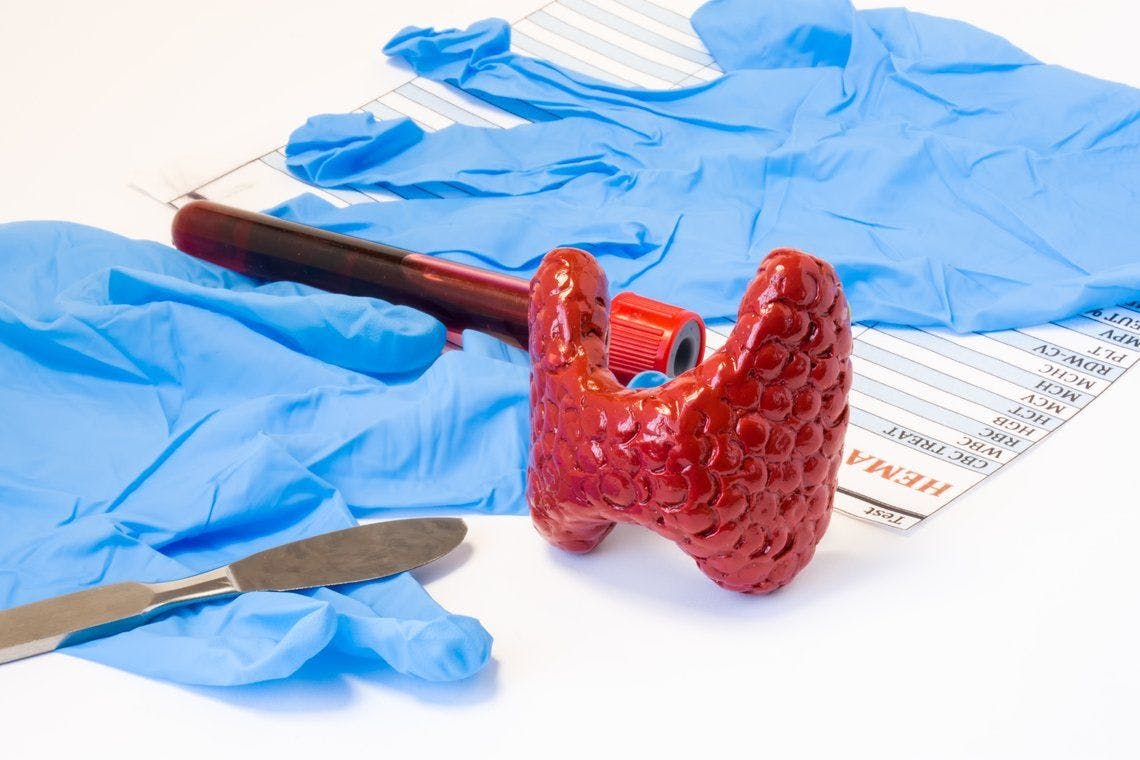 image of thyroid and surgical gloves and tools