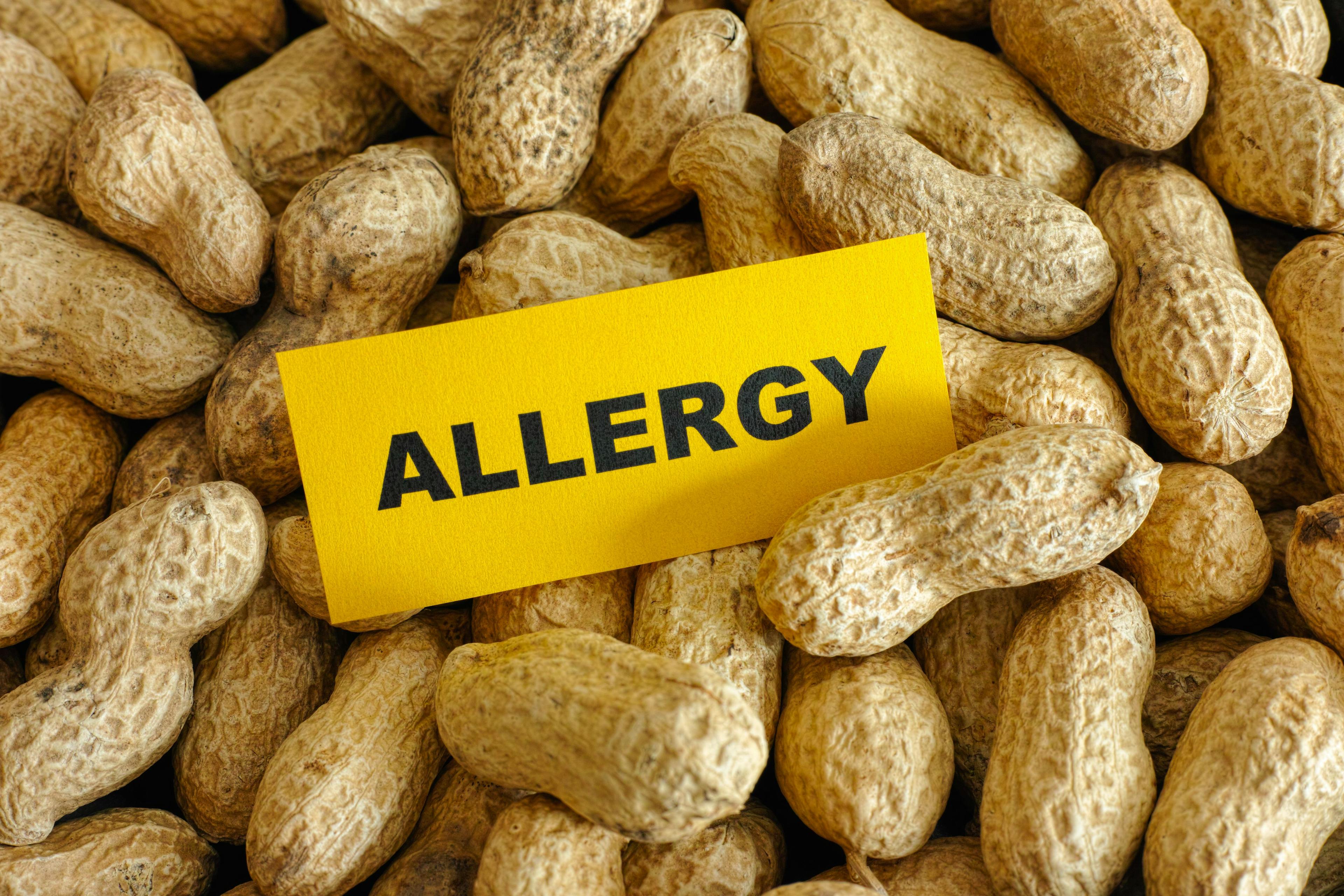 Long-term safety of epicutaneous immunotherapy with DBV712 for peanut allergy | Image Credit: © Stepan Popov - © Stepan Popov - stock.adobe.com.