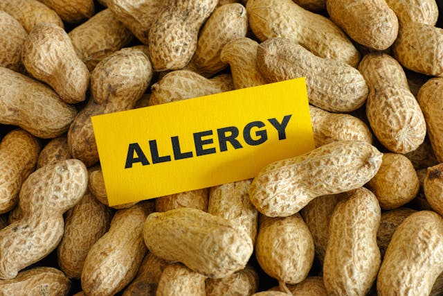Long-term safety of epicutaneous immunotherapy with DBV712 for peanut allergy | Image Credit: © Stepan Popov - © Stepan Popov - stock.adobe.com.