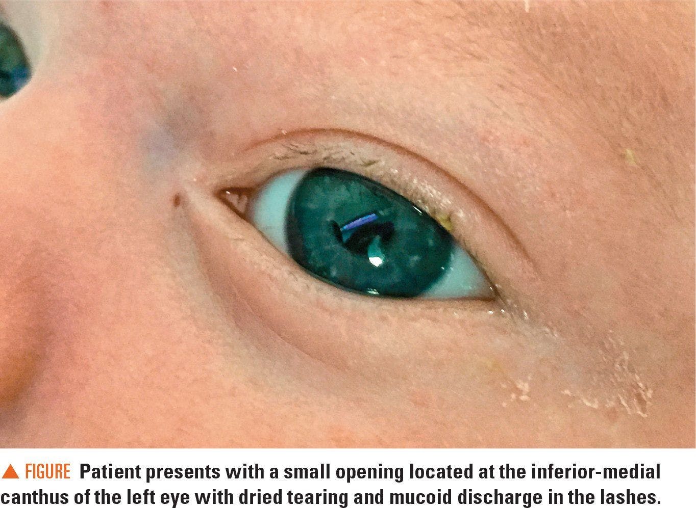 Image of patient in this case