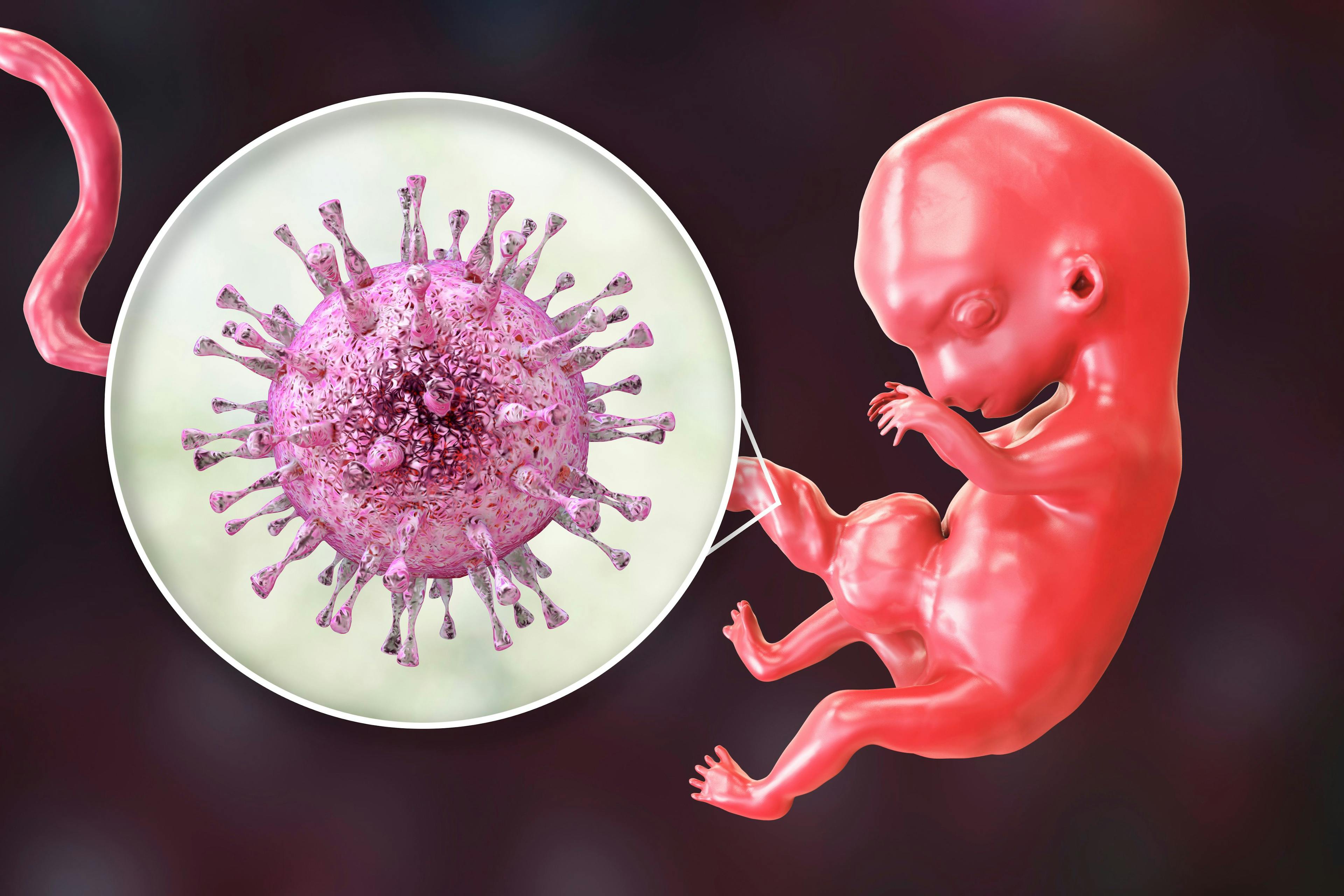 Current and upcoming strategies for prevention of CMV in neonates | Image Credit: © Dr_Microbe - © Dr_Microbe - stock.adobe.com.