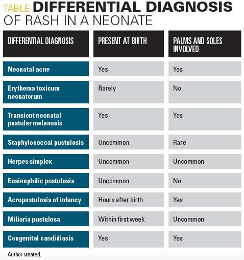 Differential diagnosis of rash in a neonate