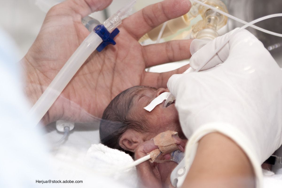 Investigating outcomes for extremely preterm infants
