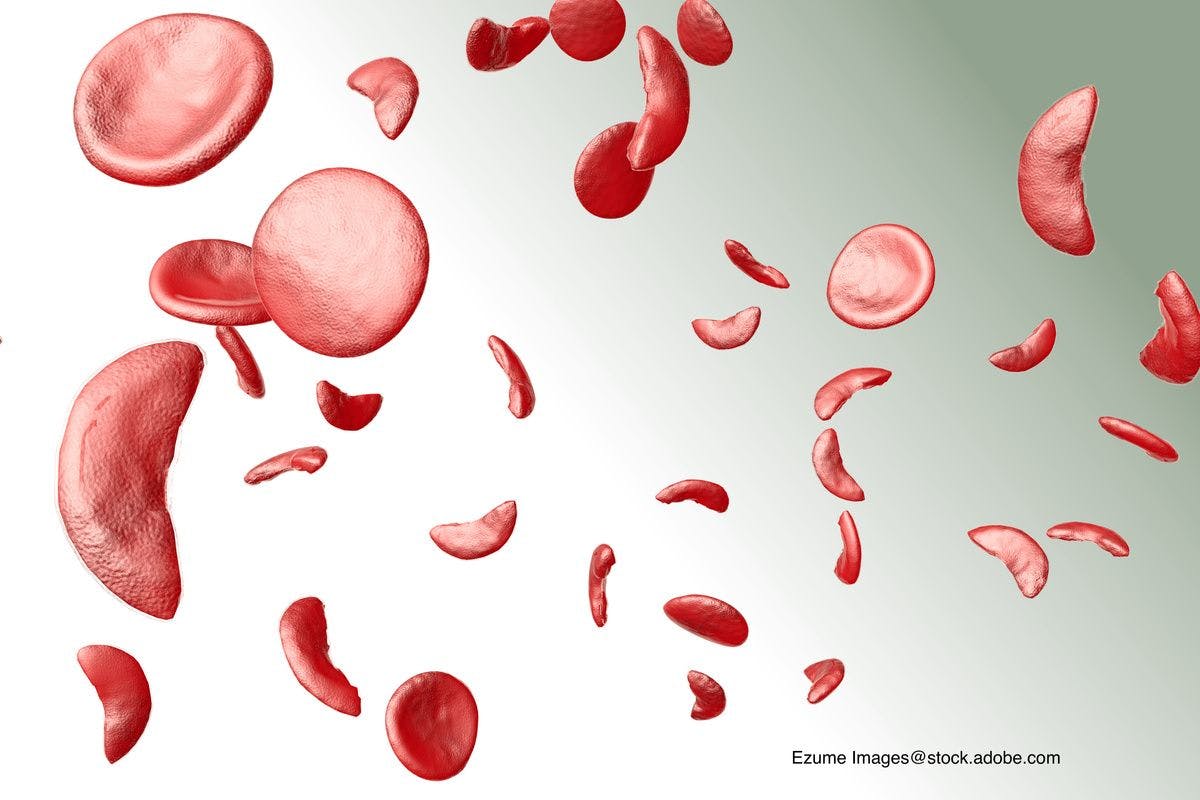 The latest Rx for sickle cell and oncology