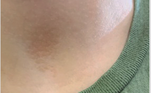 dirt-like mark on the neck
