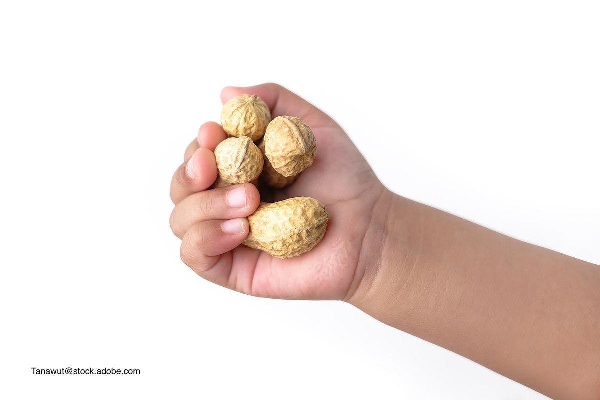 Should some infants be screened before peanut introduction?