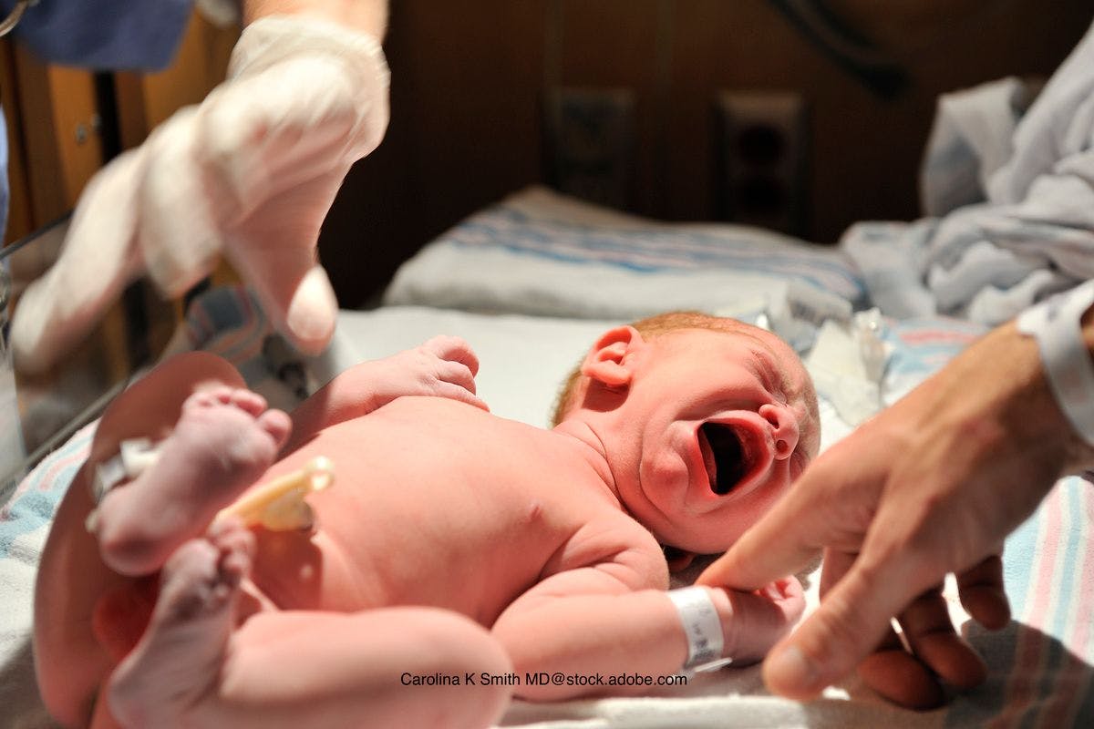 Examining mortality in infants with prenatal opioid exposure