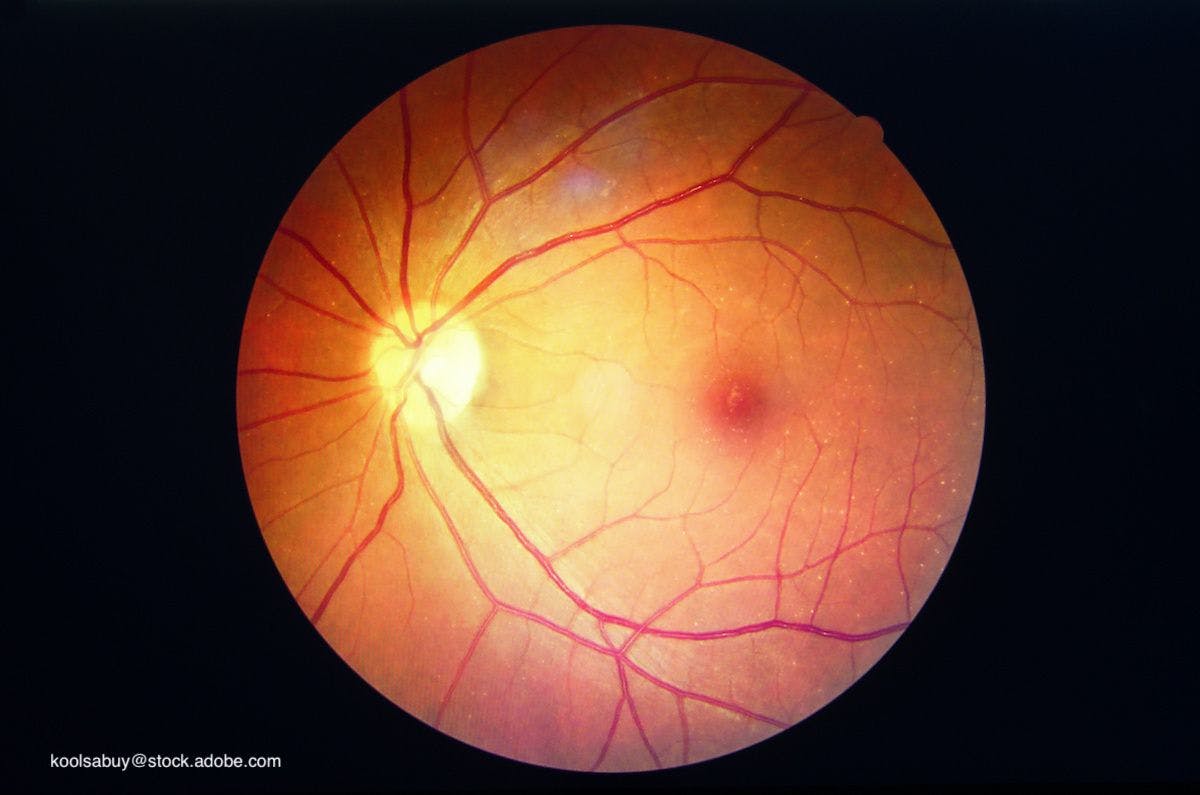 Examining the factors that lead to diabetic retinopathy in kids