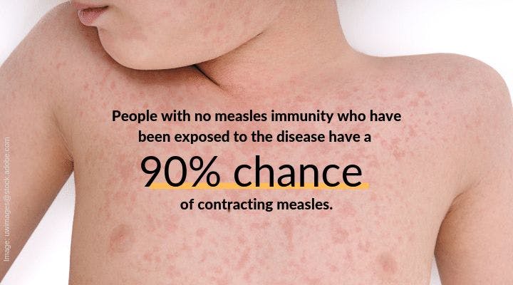 10 measles facts to share with parents