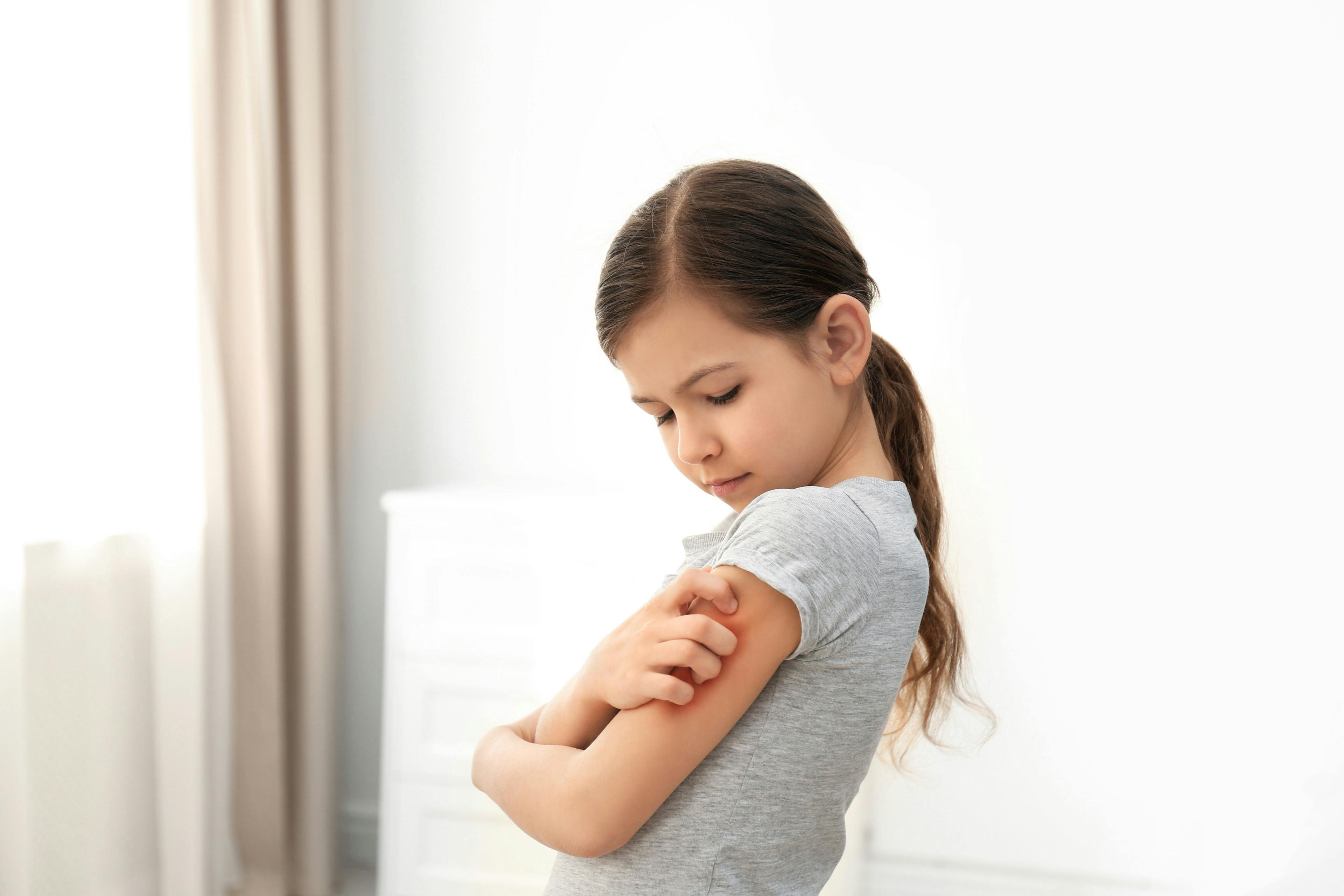 Emollients and moisturizers in caring for children with eczema
