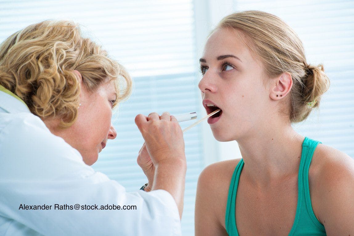 doctor examining tonsils