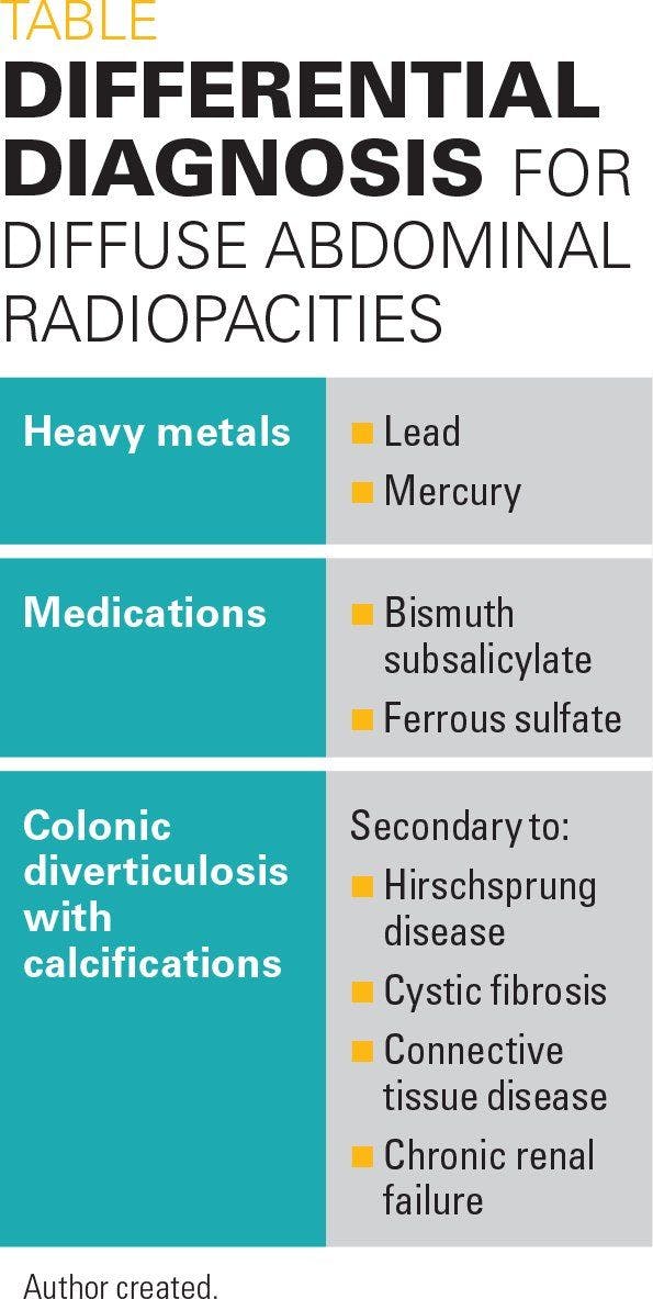 Differential diagnosis for diffuse abdominal radiopacities