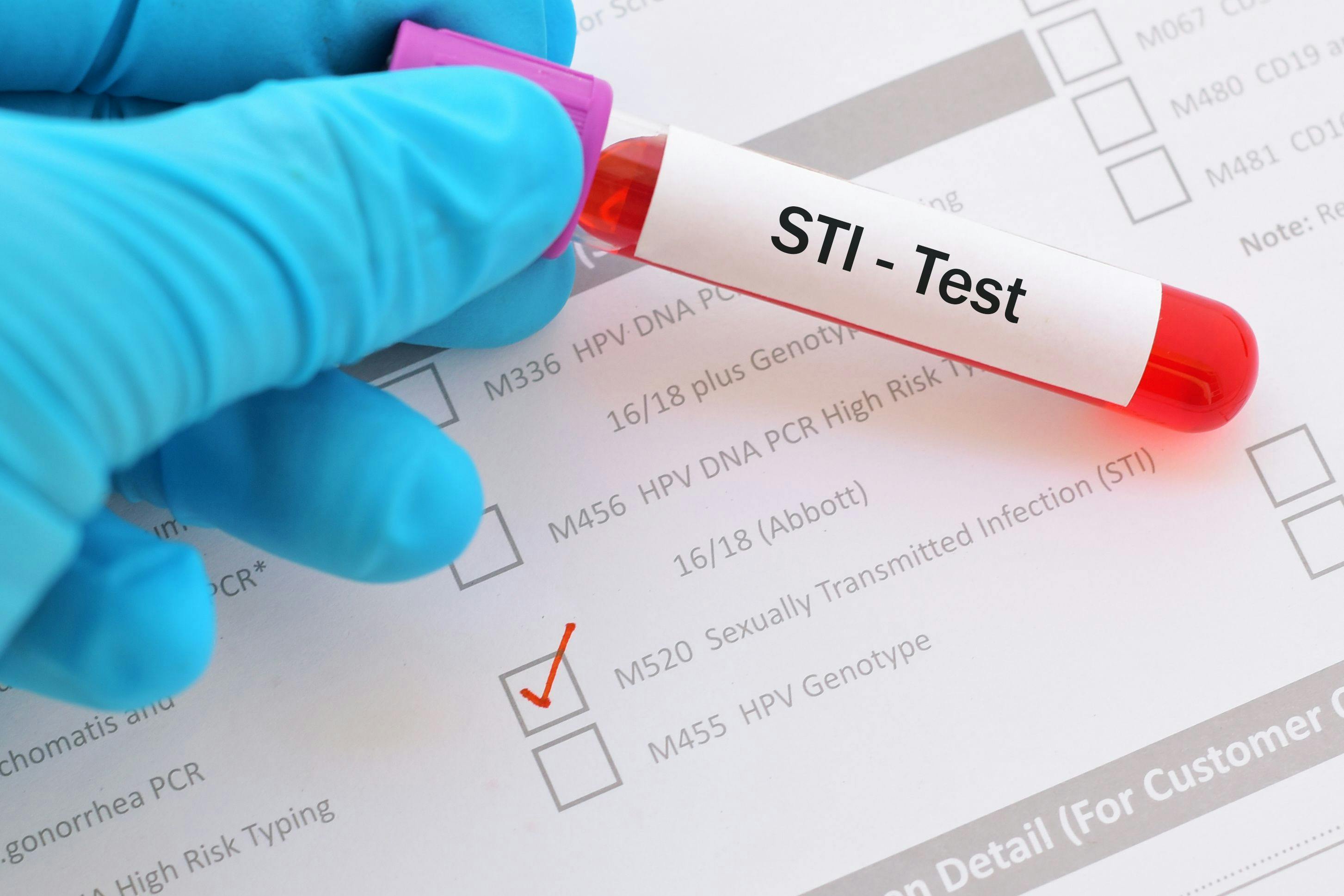 CDC: 2022 saw higher reports of sexually transmitted infection cases | Image Credit: © jarun011 - © jarun011 - stock.adobe.com.