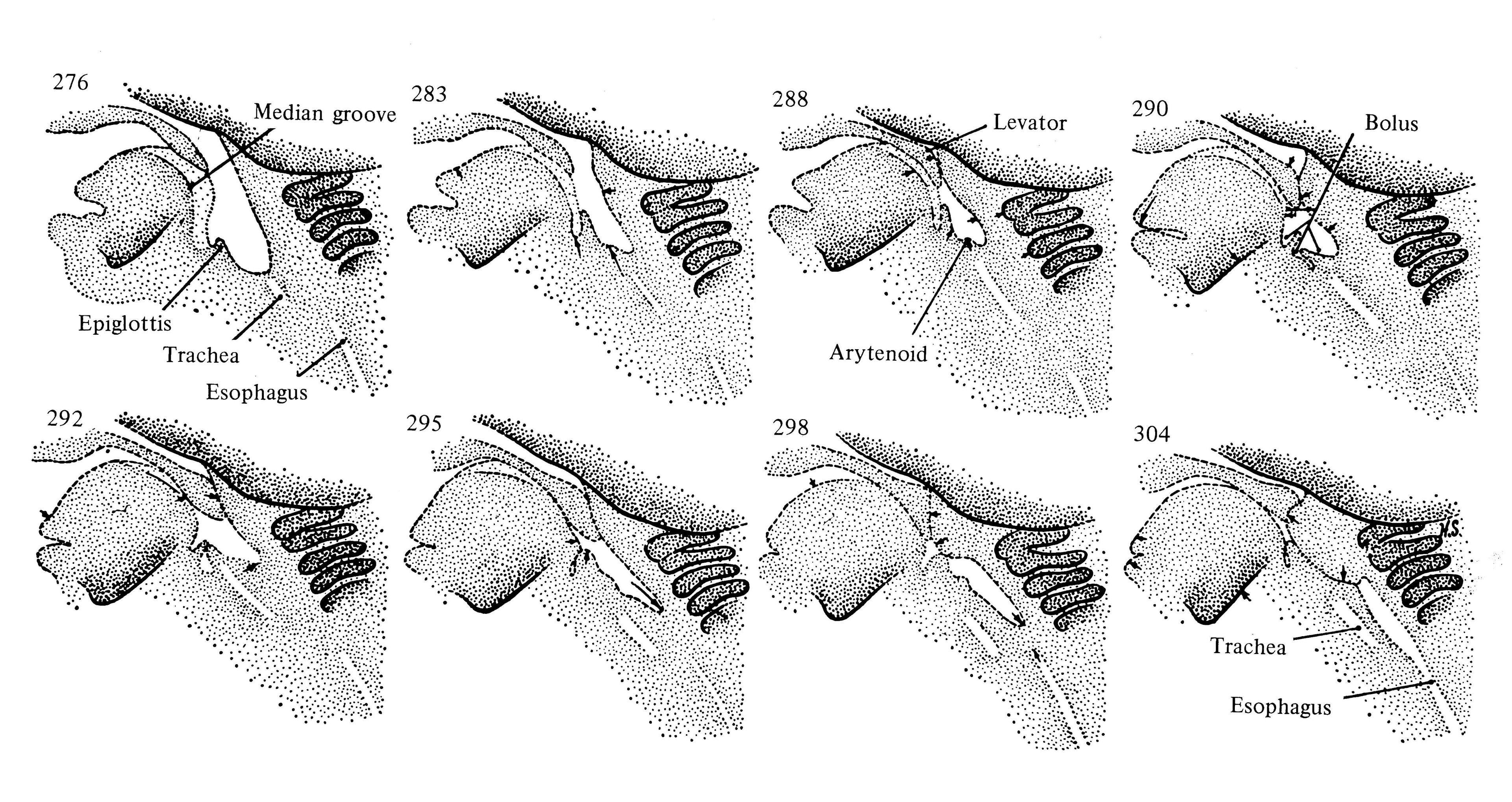 Figure 2. Sequential images from cineradiological recordings showing the movement of the pharyngeal/laryngeal structures during newborn infant swallowing. Used with permission from Bosma et al. (1966).11 Note that in these images the epiglottis is shown to partially cover the entrance to the larynx as it does in adults, and not to interlock with the soft palate. 