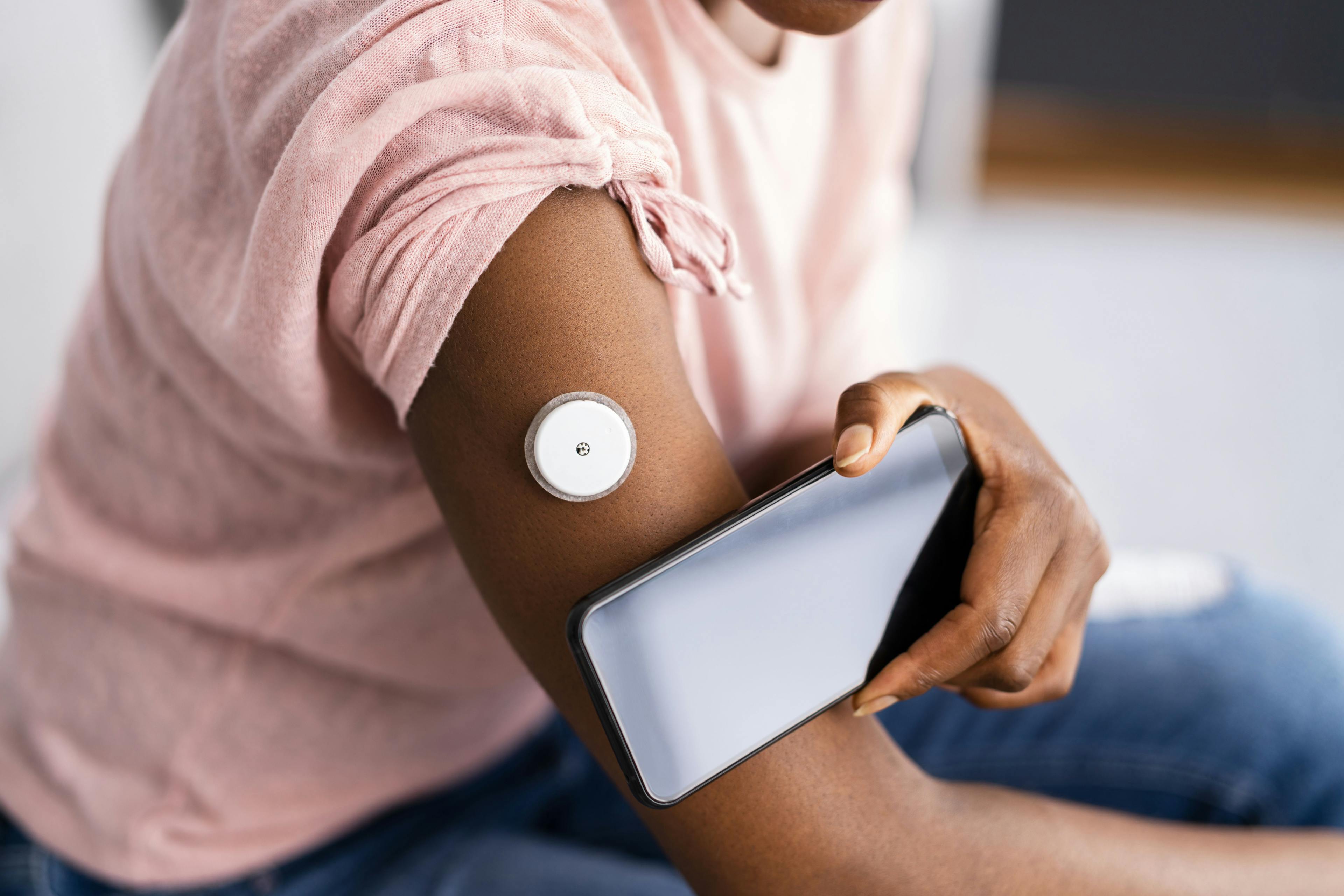 Equitable access to glucose monitoring improves HbA1c levels | Image Credit: © Andrey Popov - © Andrey Popov - stock.adobe.com.