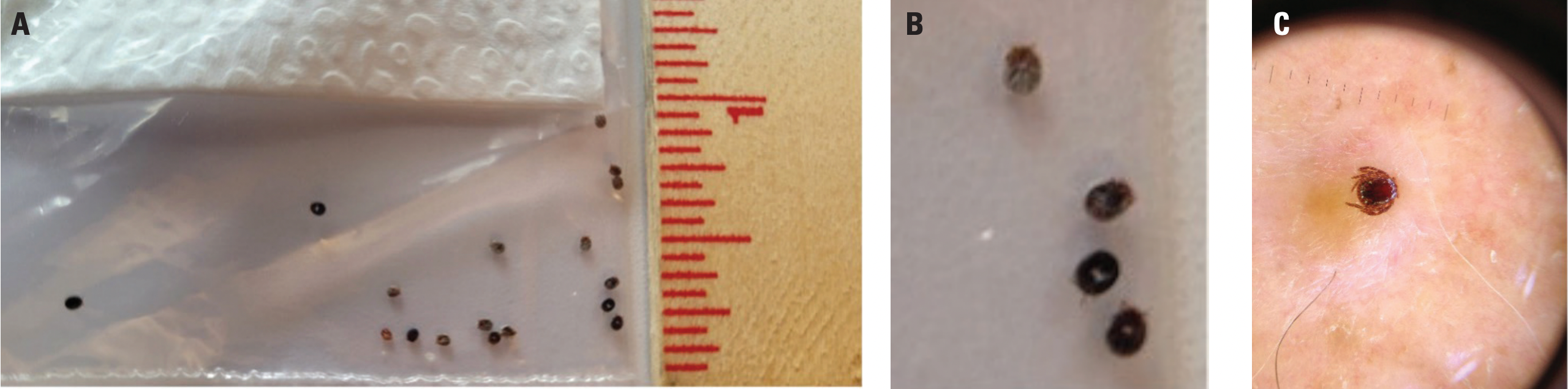 FIGURE 1. A.) Multiple ticks. B. Female ticks. C. Male tick. Click image to enlarge.
