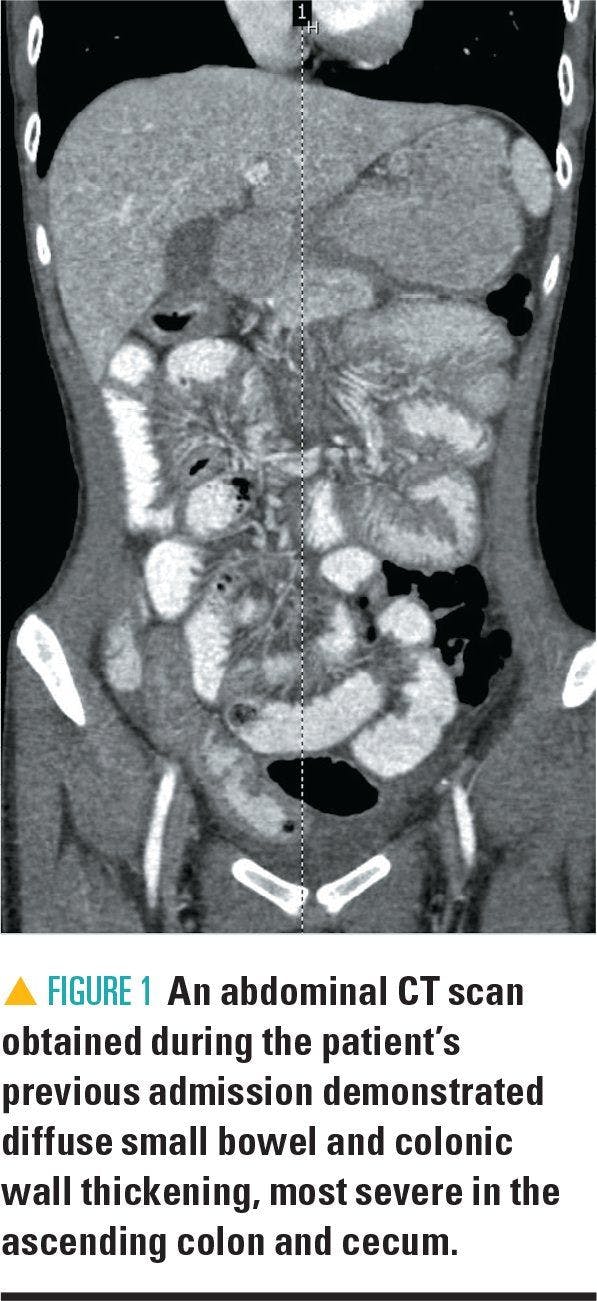 abdominal CT scan of patient