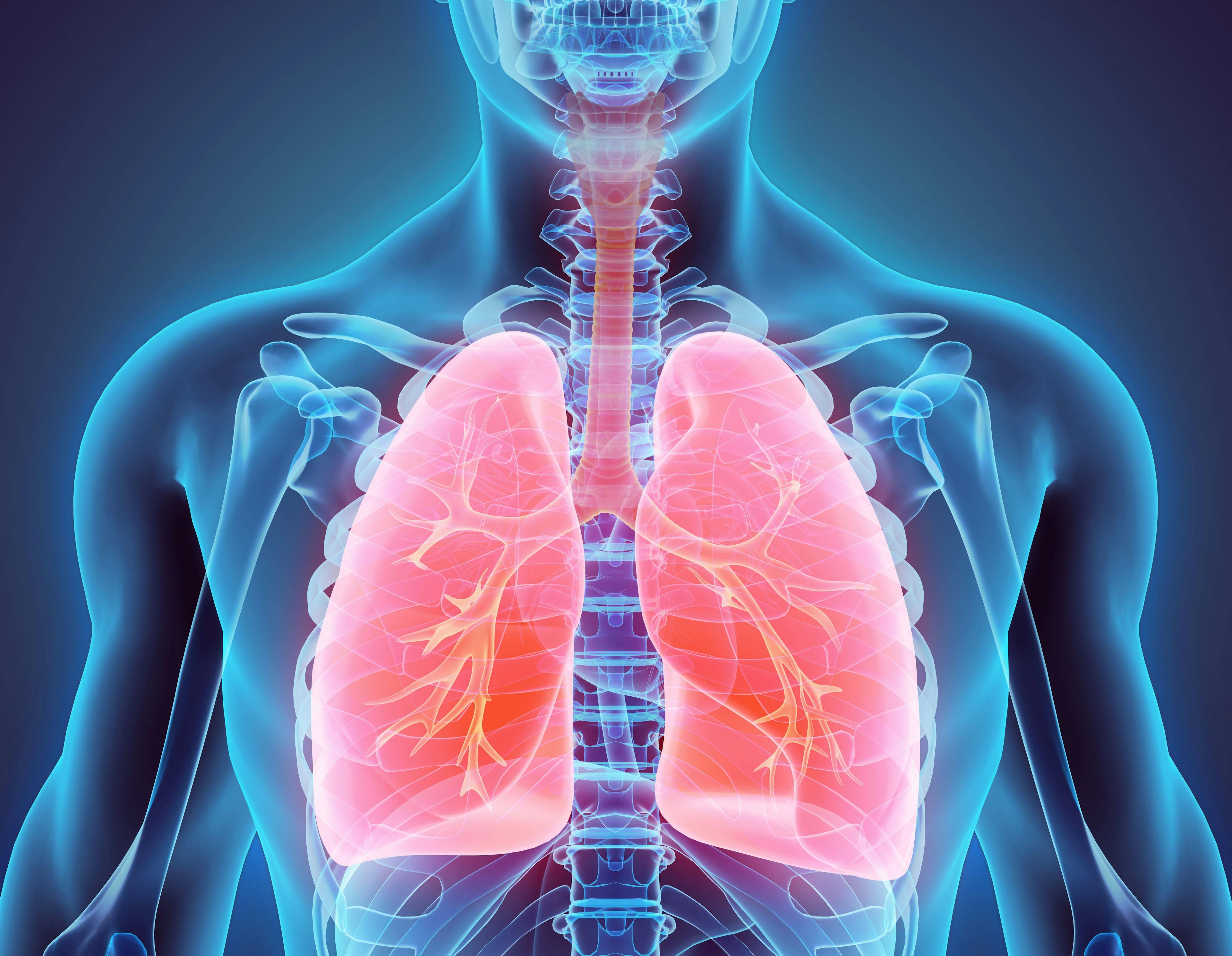 FDA accepts sNDA for nintedanib for treatment of fibrosing interstitial lung disease | Image Credit: © yodiyim - © yodiyim - stock.adobe.com.