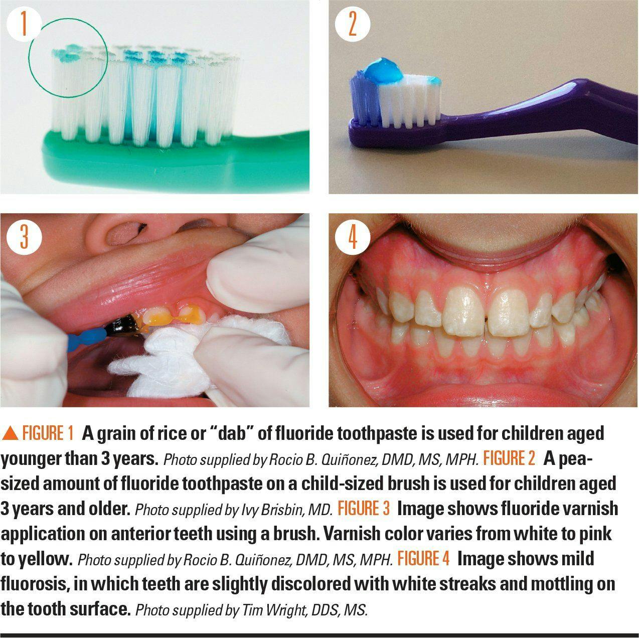 Images of fluoride toothpaste and fluoride varnish