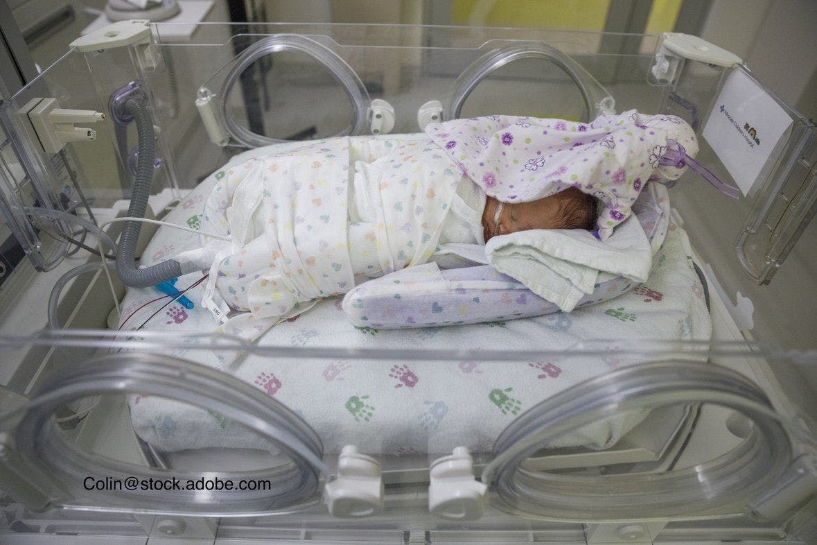 image of newborn in a NICU