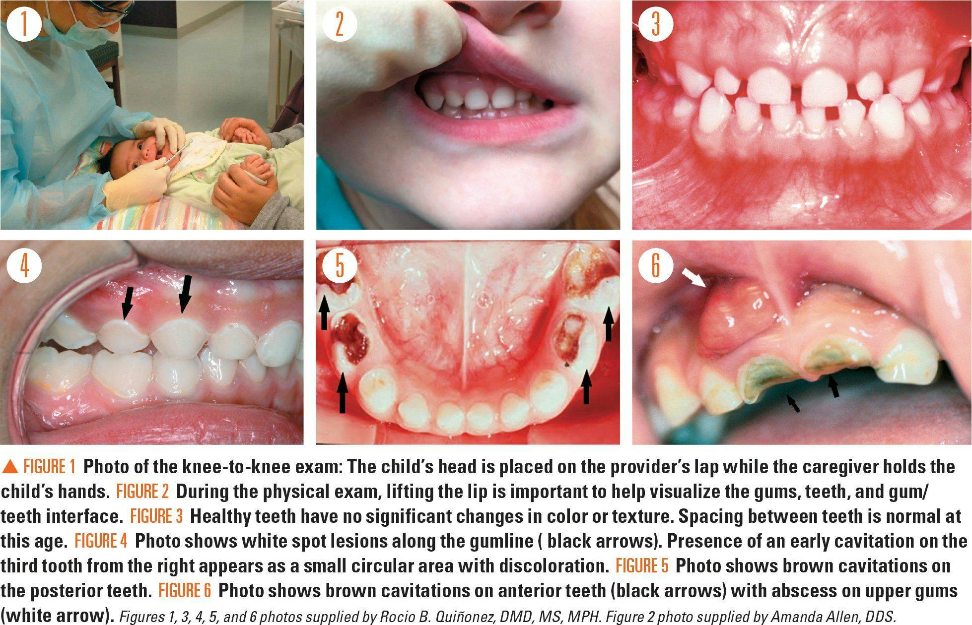 Figure 1-6 showing oral care exams and photos of teeth