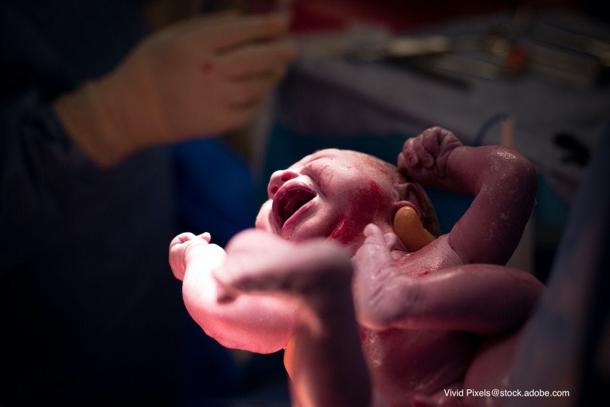 Study finds vast variations in newborn skincare