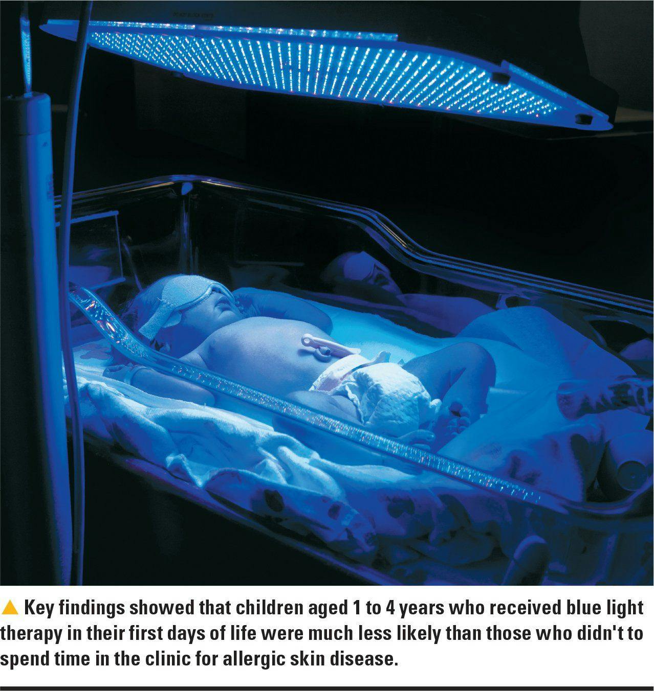 image of infant undergoing blue light therapy