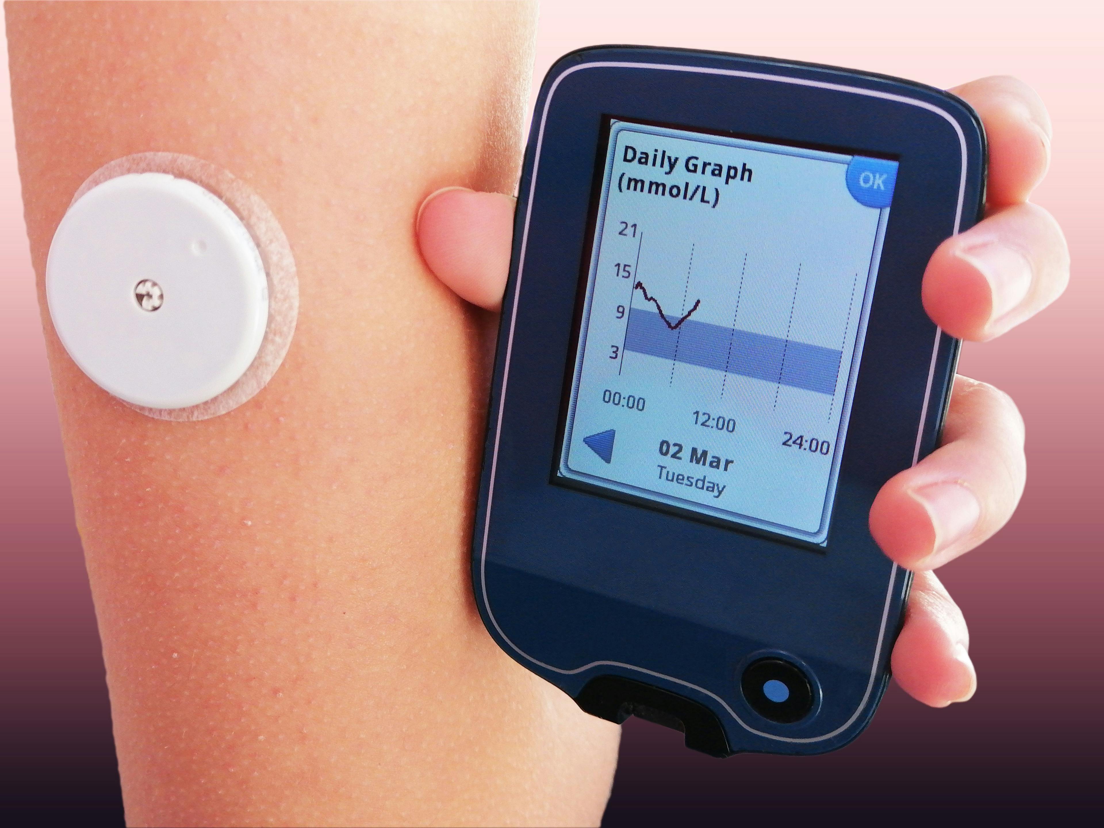  Continuous glucose monitors ease care for parents of young children with T1D | Image Credit: © Dragoljub - © Dragoljub - stock.adobe.com.