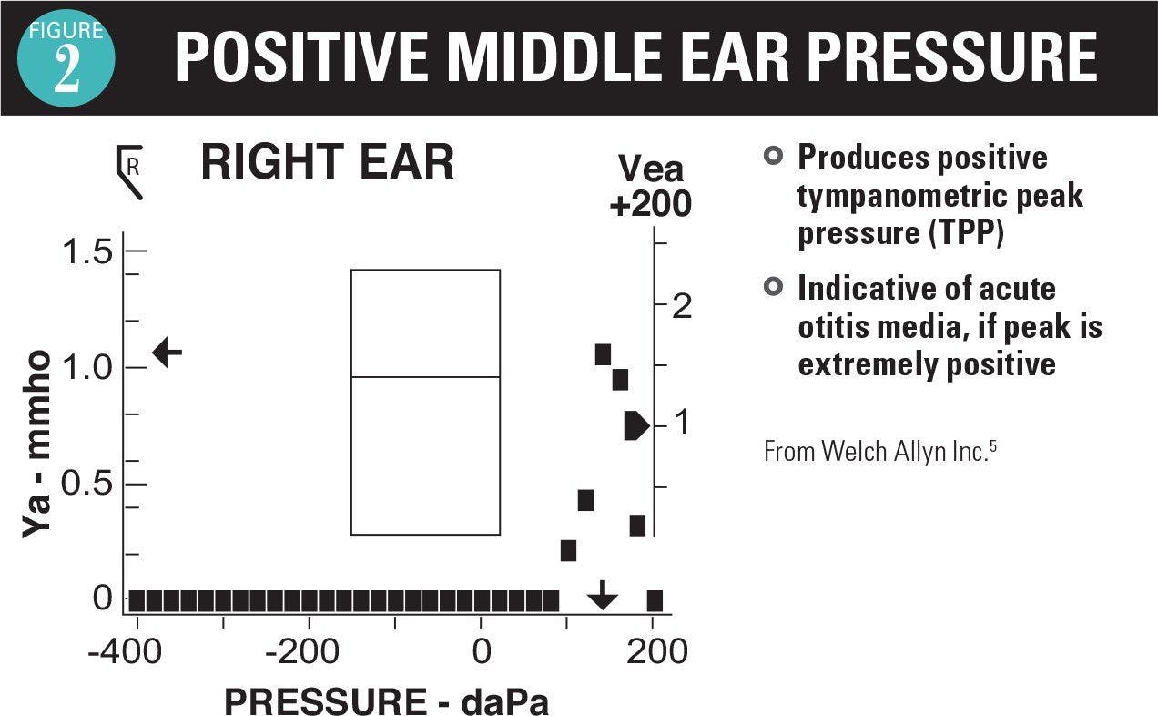 Positive ear pressure