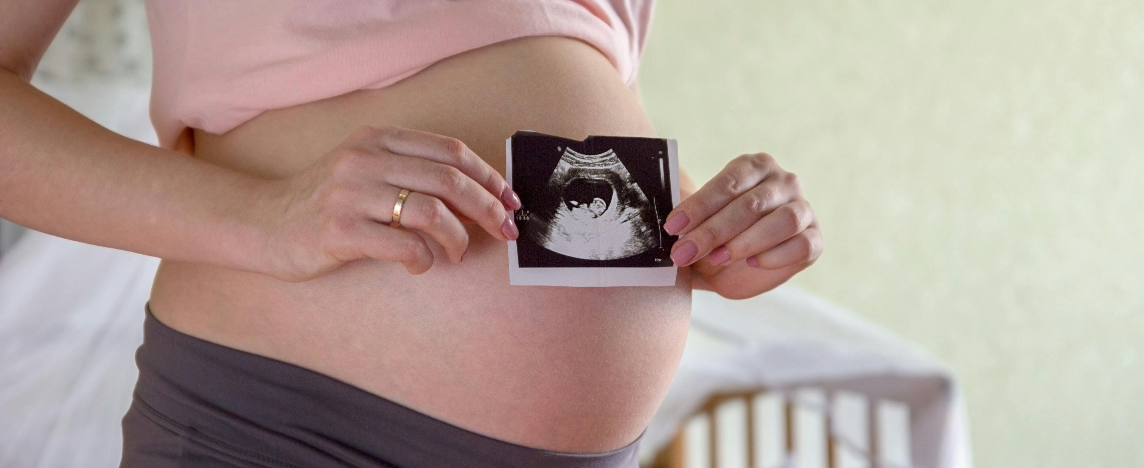Pregnant woman holding sonogram | Image Credit: © ruslan_khismatov - © ruslan_khismatov - stock.adobe.com.