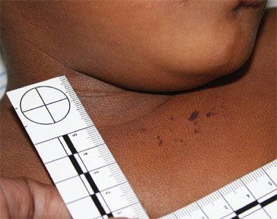 Unusual Lesions-Abuse or Accidental Injury?