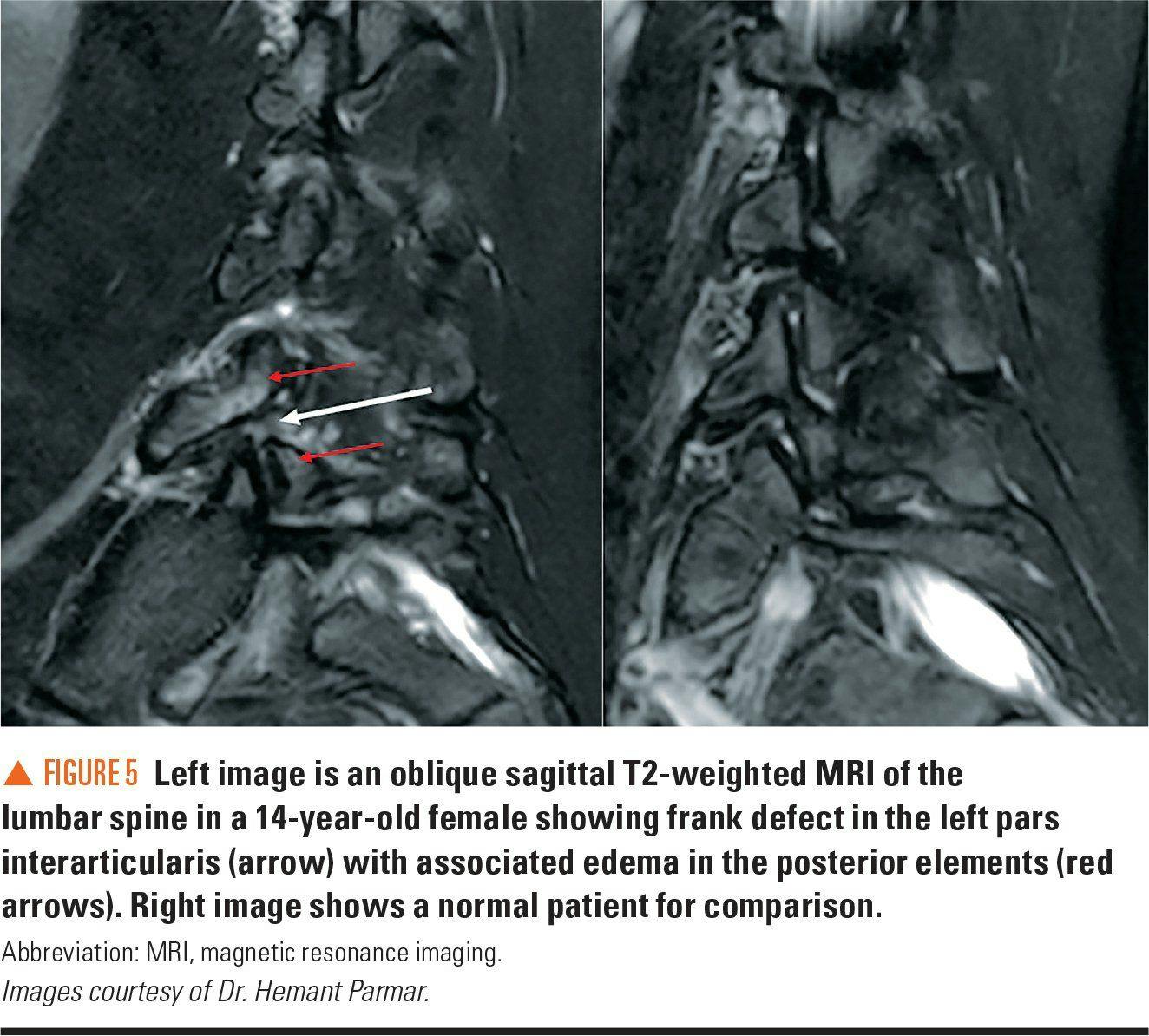 Imaging showing lower back