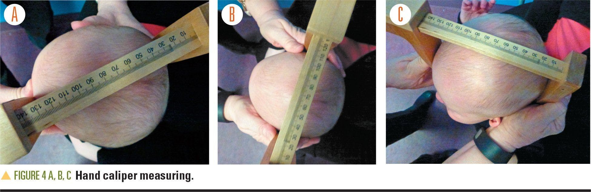 Hand caliper measurement