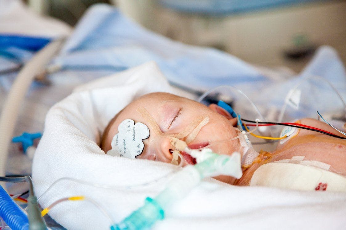 Does a single anesthesia exposure in infancy have a long-term cognitive effect?