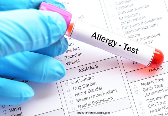 Using tests to determine pet allergy triggers